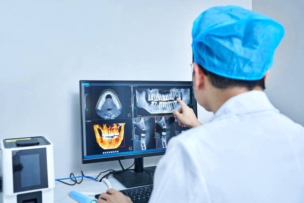 Best Emergency Wisdom Teeth Removal in Oakfield, WI